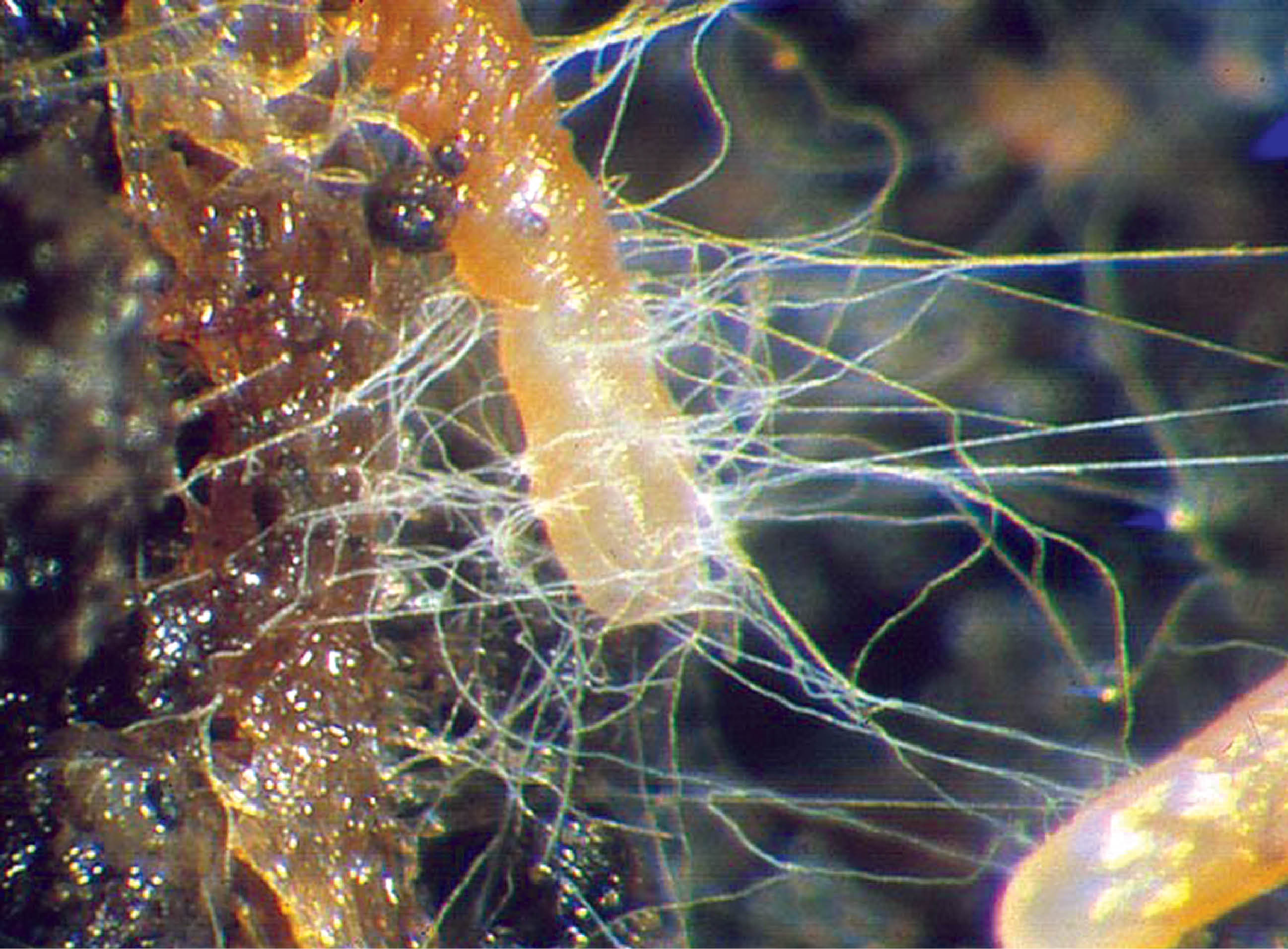 Mycorrhiza: Symbiosis between Fungus and Plant Root